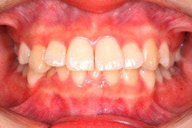 연산동교정치과