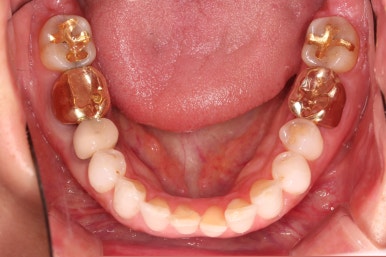 연산동부분교정