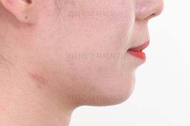 연산동교정치과