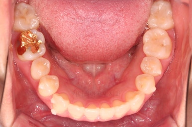 부산인비절라인