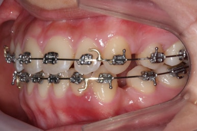 부산교정전문의