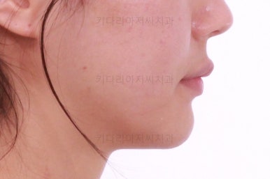 연산동교정치과