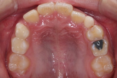 부산어린이교정
