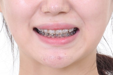 연산동교정치과