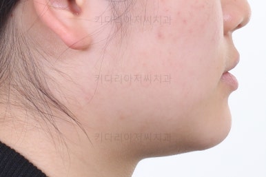 연산동교정치과