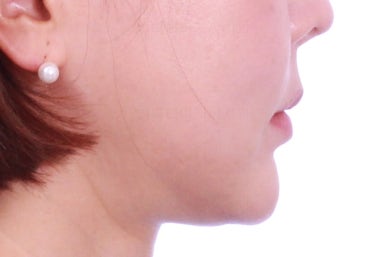 연산동부분교정