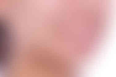 부산연산역치아교정