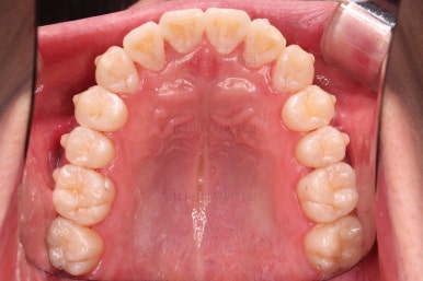 부산인비절라인