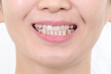 부산인비절라인