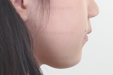 부산초등학생교정