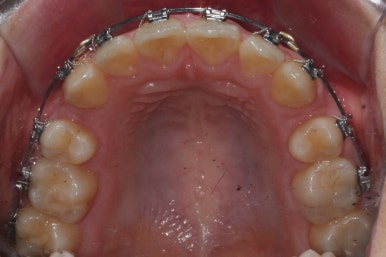 부산교정전문의