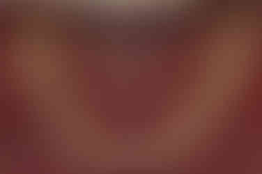 부산매복치아교정