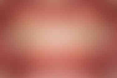 부산치아교정추천