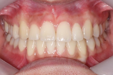 부산연산동청소년교정