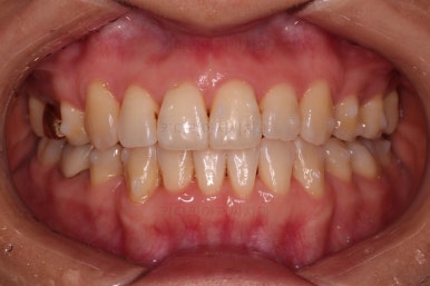 부산인비절라인