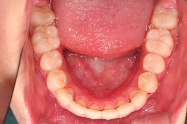 부산치아교정치과