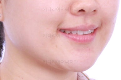 부산인비절라인