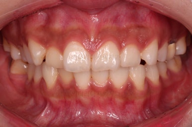 연산동교정치과