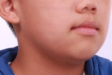 부산어린이교정