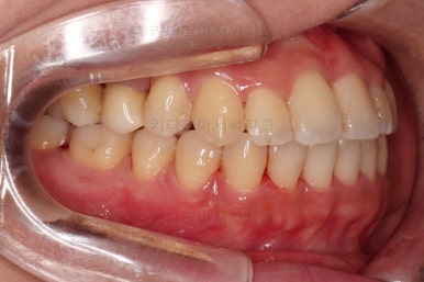 부산연산동치과