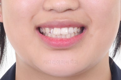 사직동교정치과