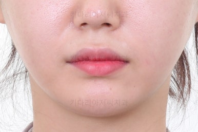 연산동교정치과