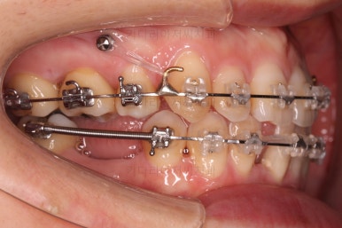 부산재교정치과