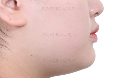 부산교정치과추천