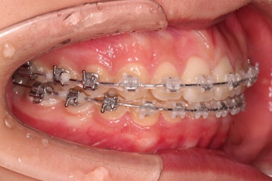 부산교정전문의