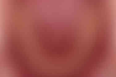 부산치아교정치과