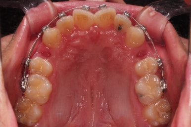 부산교정치과추천