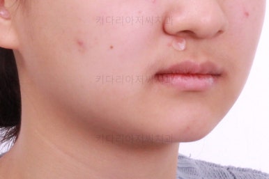 부산청소년교정치과