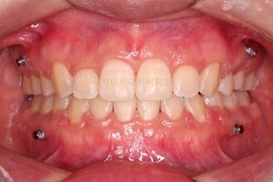 사직동교정치과