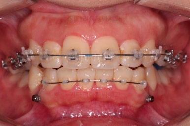 부산무턱교정치과