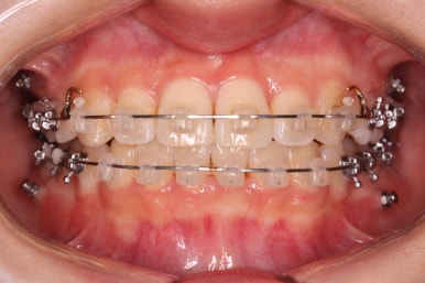 연산동교정치과