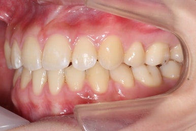 부산교정전문의