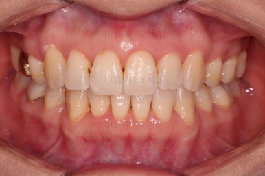 부산인비절라인