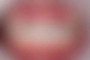 연산동덧니교정