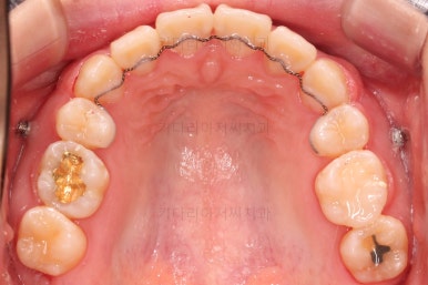 부산무턱교정치과