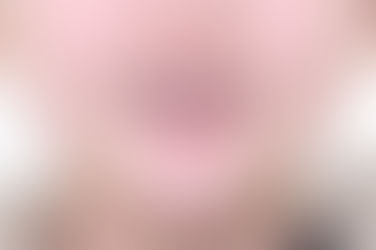 부산덧니교정