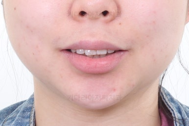 부산연산동교정치과