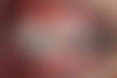 부산연산동교정치과