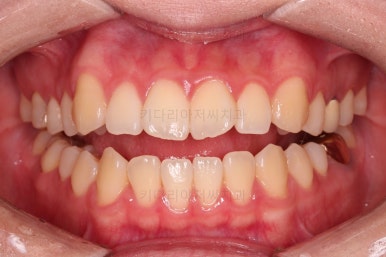 부산치아교정잘하는곳