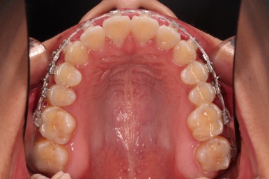 부산연산역치아교정