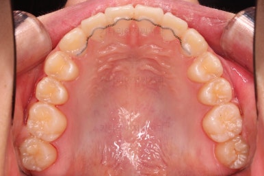 부산교정전문의