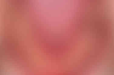 부산치아교정잘하는곳