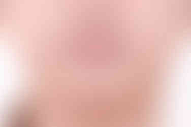 부산토끼치아교정