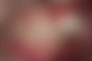 부산토끼치아교정