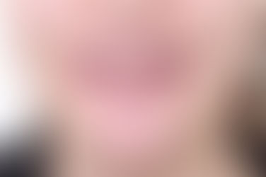 부산개방교합