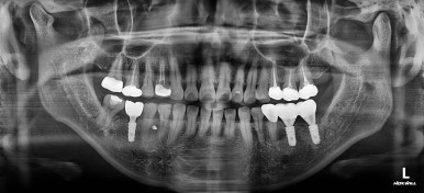 연산동부분교정